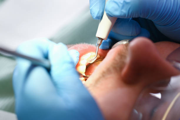 Best Emergency Dental Care for Trauma or Injury in Scissors, TX