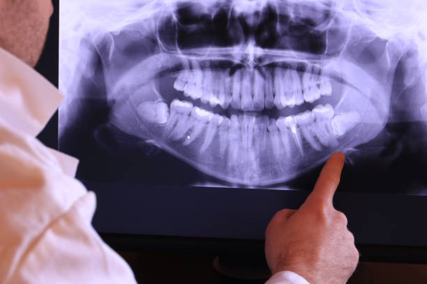Best Emergency Broken Tooth Repair in Scissors, TX
