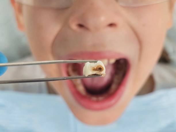 Best Walk-In Emergency Dentist in Scissors, TX